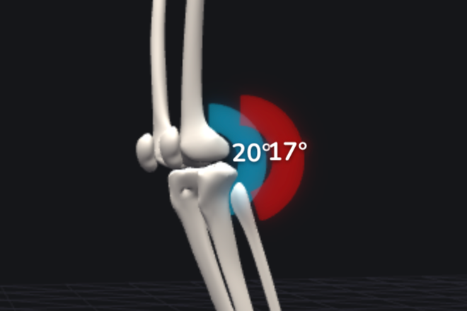 Why TropX Puts Two Sensors on Every Leg